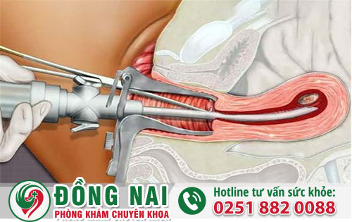 Phương Pháp Bỏ Thai 8 Tuần Đến 12 Tuần An Toàn