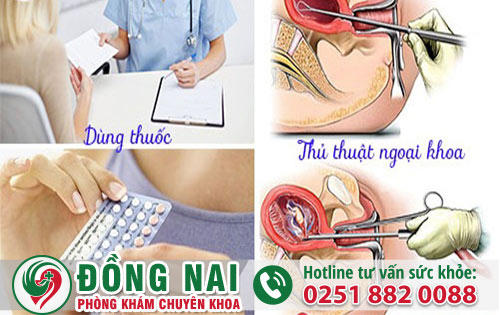 Chi Phí Bỏ Thai Hiện Nay Là Bao Nhiêu?