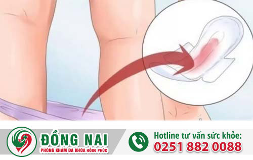 Máu báo thai là gì?