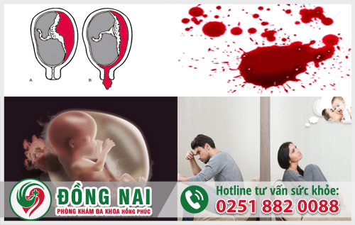 Những biến chứng nguy hại do  tự ý uống thuốc tránh thai tại nhà gây ra