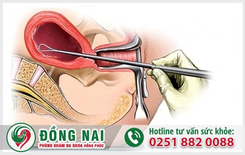 Cách phá thai tại nhà an toàn, đơn giản