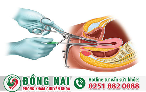 Phương pháp nạo thai an toàn