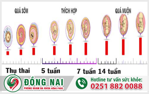 Thế nào là phá thai an toàn?